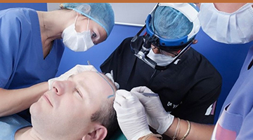 Chirurgie capillaire Chirurgie capillaire