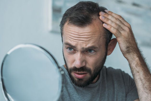 Pourquoi perd-on ses cheveux ?
