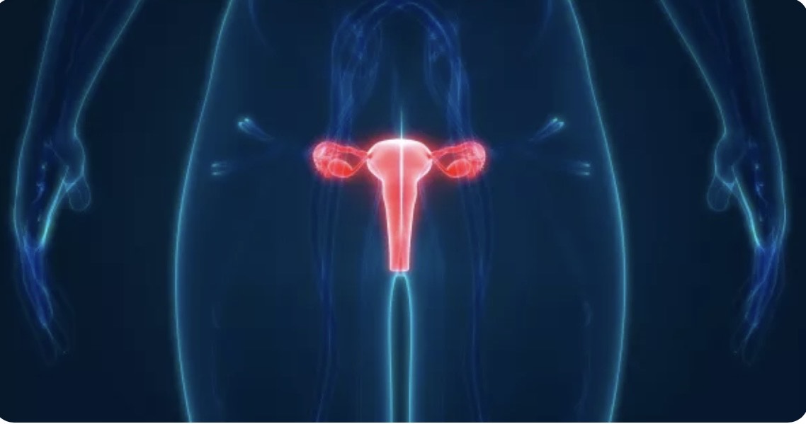 Le lissage des cheveux entraÃ®nerait un risque de cancer de lâ€™utÃ©rus